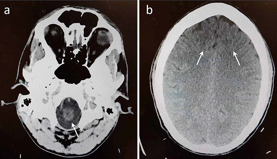 Phenibut hcl powder is like an "intelligent regulator" Phenibut hcl powder is like an "intelligent regulator"