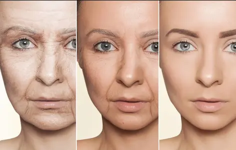 Decapeptide-12 powder