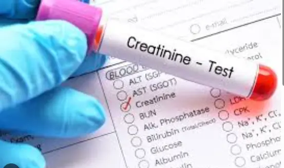 creatinine test
