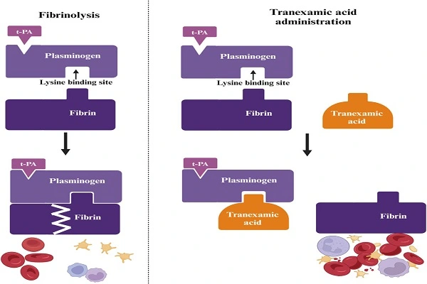 Tranexamic Acid Powder efficacy chart Tranexamic Acid Powder efficacy chart