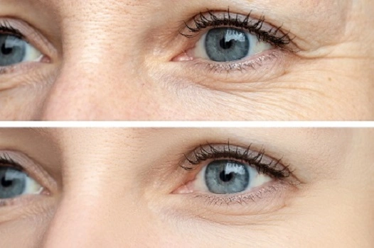 uses of Acetyl Octapeptide-3