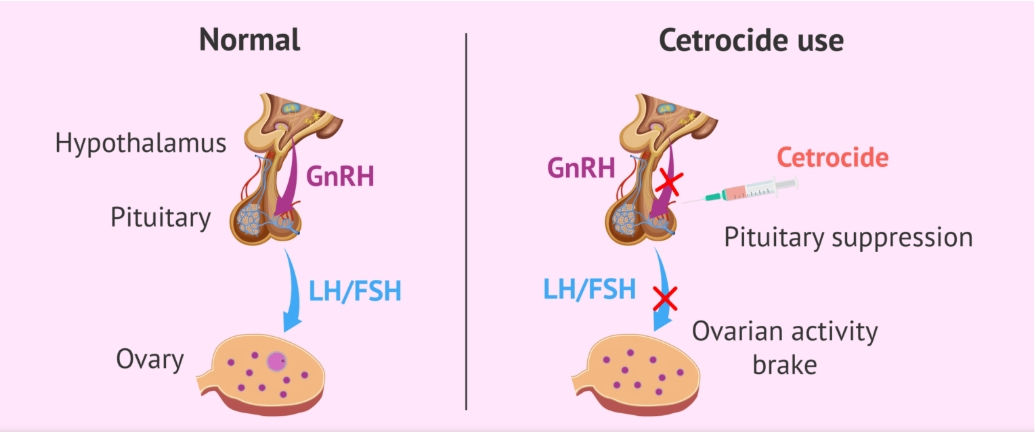 Cetrorelix acetate peptide powder Cetrorelix acetate peptide powder