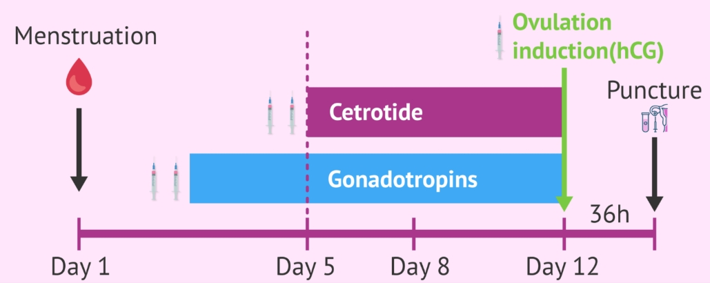 Timing of the administration of Cetrotide