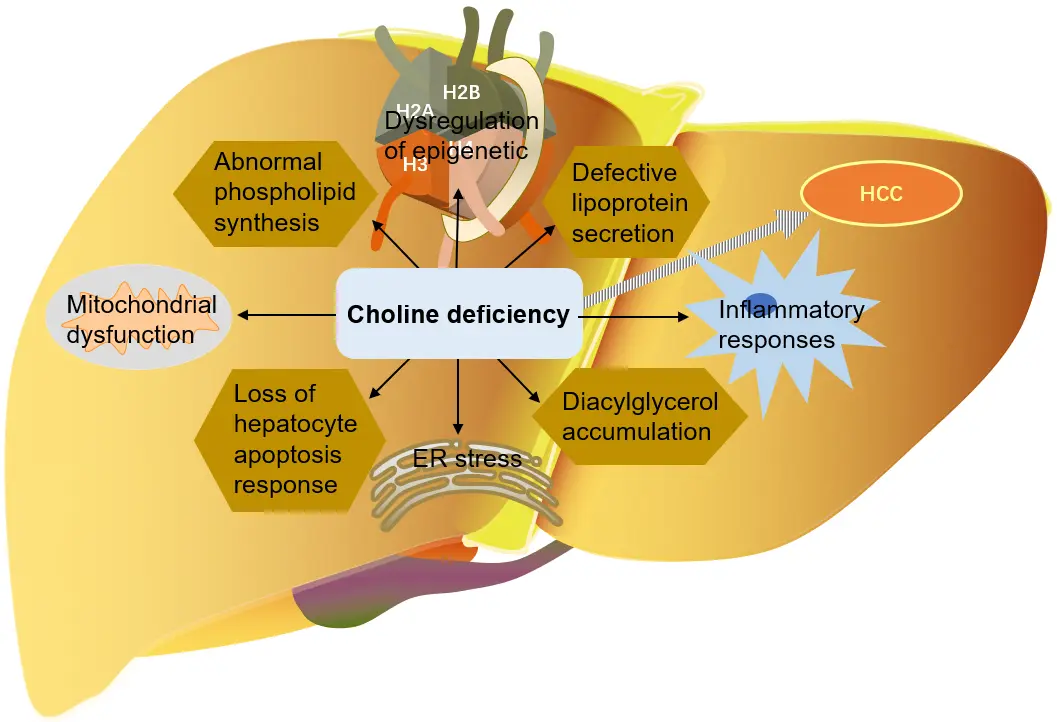 Role and mechanism of Choline CDP metabolism in nonalcoholic fatty liver disease and cancer Role and mechanism of Choline CDP metabolism in nonalcoholic fatty liver disease and cancer