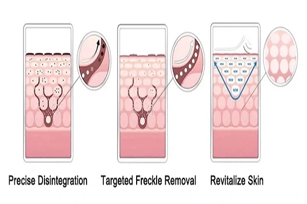 4-Butylresorcinol Powder Efficacy Chart 4-Butylresorcinol Powder Efficacy Chart