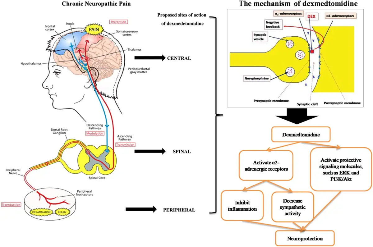 Mechanism of dexmedetomidine HCl Mechanism of dexmedetomidine HCl