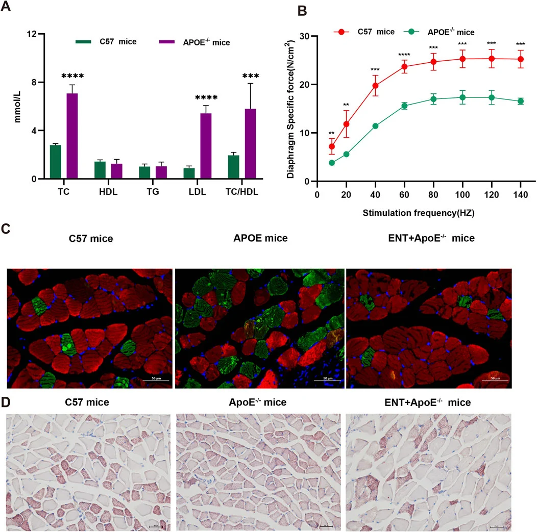 Entacapone reduced muscle atrophy associated with hyperlipidemia