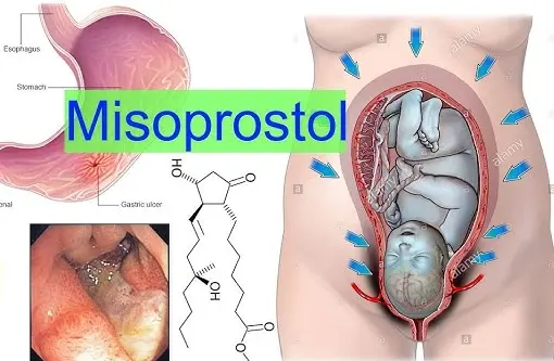 uses of Misoprostol