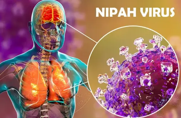 Nipah virus