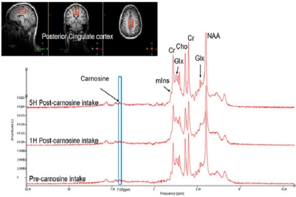 L-Carnosine Powder 1 L-Carnosine Powder 1