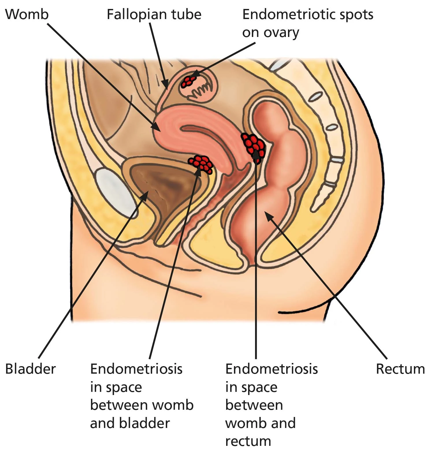 Research on Dienogest Powder