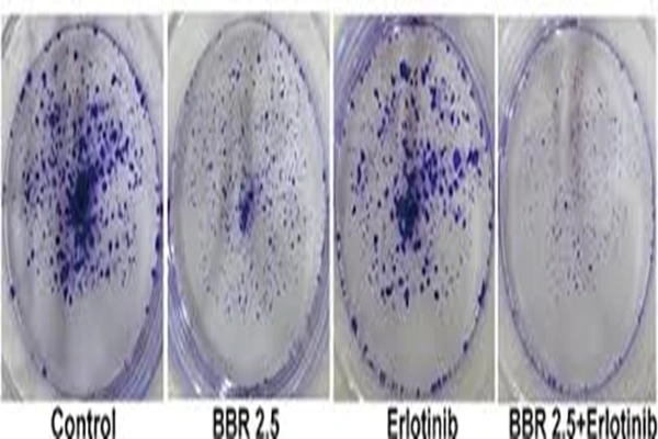 Berberine Chloride powder Berberine Chloride powder