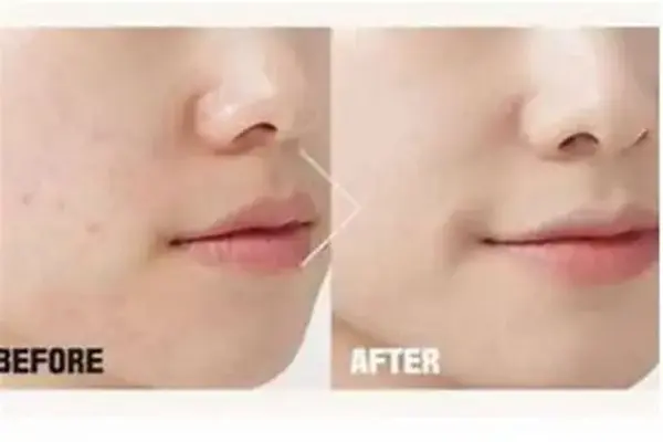 Madecassoside powder