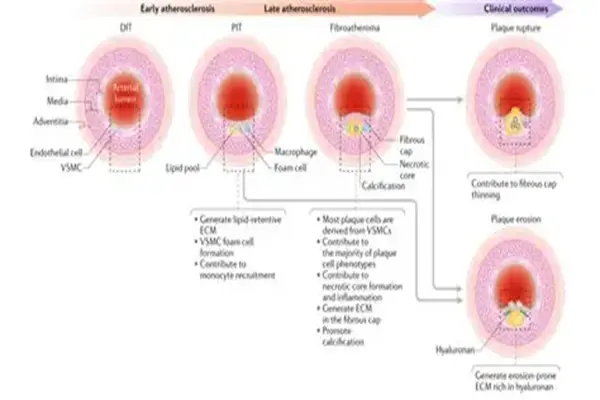 Nattokinase Powder Nattokinase Powder