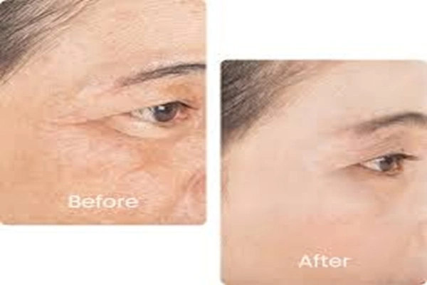 Anti-aging effects of GHK-Cu Anti-aging effects of GHK-Cu