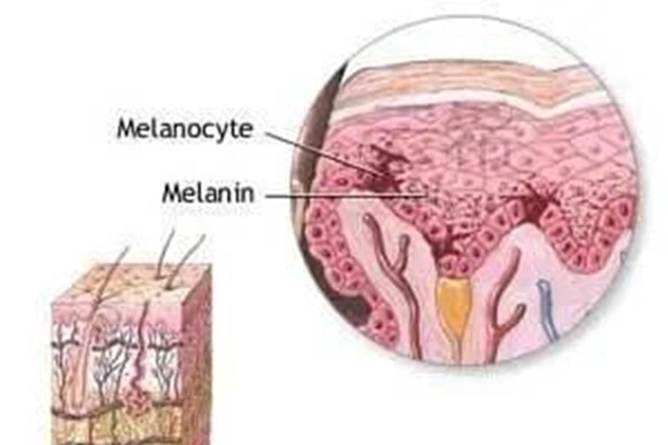 Acetyl Hexapeptide-1