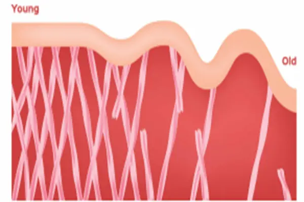 Acetyl Tetrapeptide-11 Acetyl Tetrapeptide-11