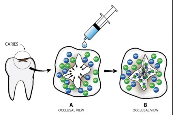 Mechanism of action of Oligopeptide P11-4 Mechanism of action of Oligopeptide P11-4