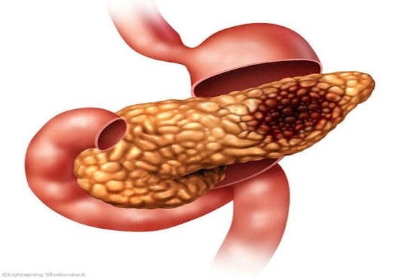 Effects of Streptozotocin on the Pancreas