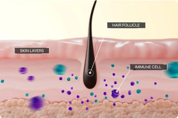 Mechanism of action of Ritlecitinib powder Mechanism of action of Ritlecitinib powder