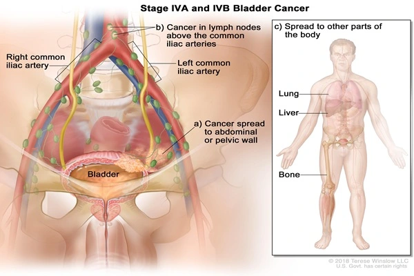 The effects of Erdafitinib The effects of Erdafitinib