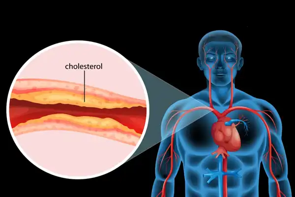 The function of OTR-AC sarms